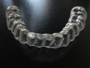 Bite dentale