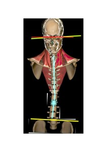rachide senz omeri deviato1 con linee corretto